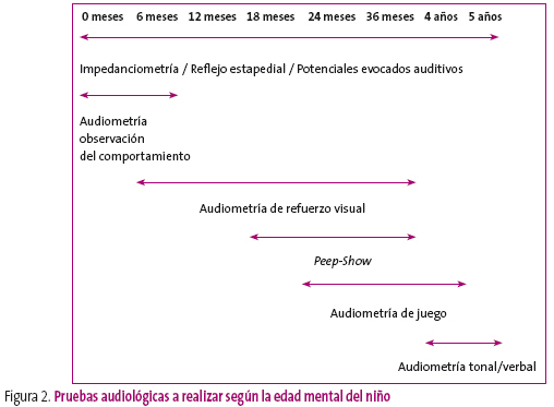 Figura 2. Pruebas audiológicas a realizar según la edad mental del niño