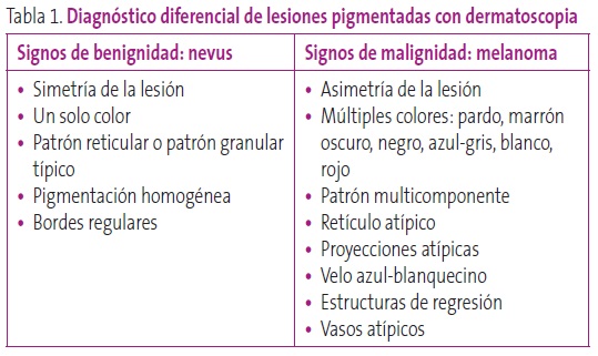Tabla 1. Diagnóstico diferencial de lesiones pigmentadas con dermatoscopia.