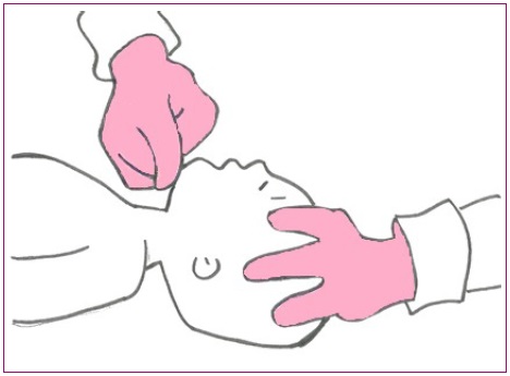 Figura 2. Maniobra frente-mentón en el lactante sin hipextensión del cuello.