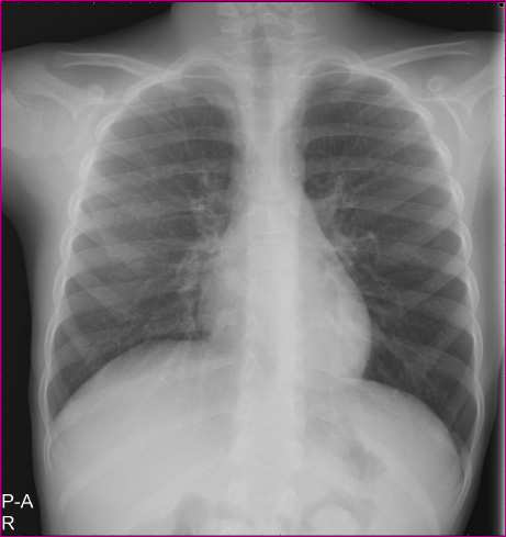 Figura 1. Radiografía posteroanterior.