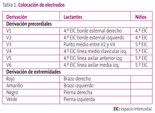 Tabla 1. Colocación de electrodos