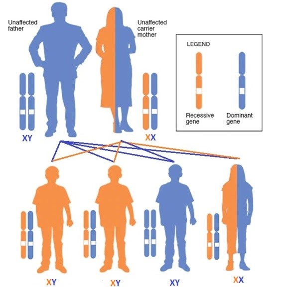 Herencia ligada a X, en nuestro caso, de síndrome de Hunter