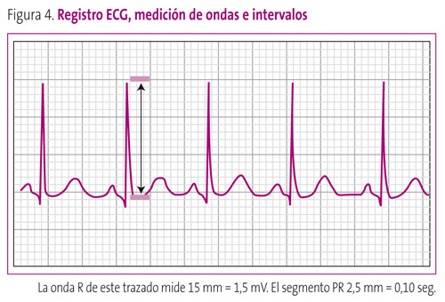 Figura 4. Registro ECG, medición de ondas e intervalos