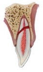 Figura 7. Fractura de raíz.