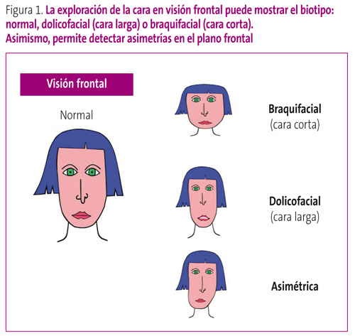 Figura 1. La exploración de la cara en visión frontal puede mostrar el biotipo: normal, dolicofacial (cara larga) o braquifacial (cara corta). Asimismo, permite detectar asimetrías en el plano frontal