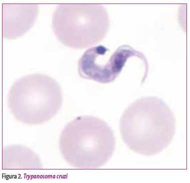 Figura 2. Trypanosoma cruzi