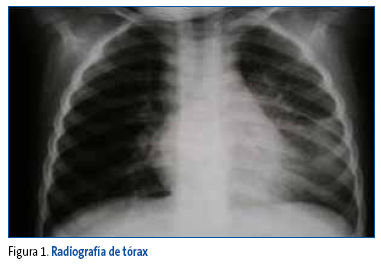 Figura 1. Radiografía de tórax