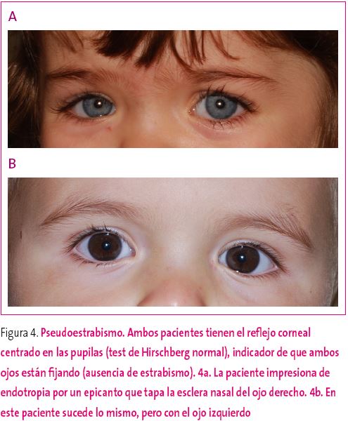 pediatrie oftalmolog consultari emoxipina
