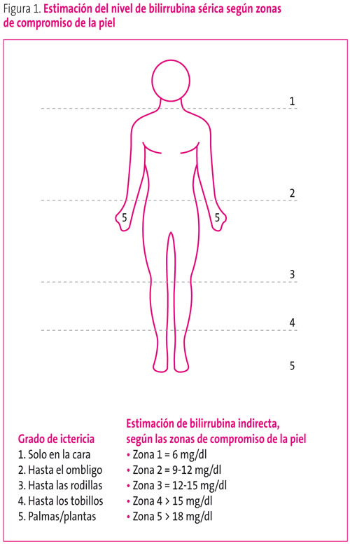 Figura 1. Estimación del nivel de bilirrubina sérica según zonas de compromiso de la piel